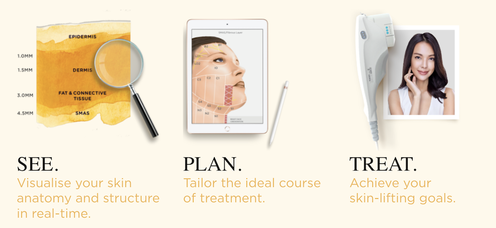 Ultherapy SPT See Plan Treat Protocol Singapore