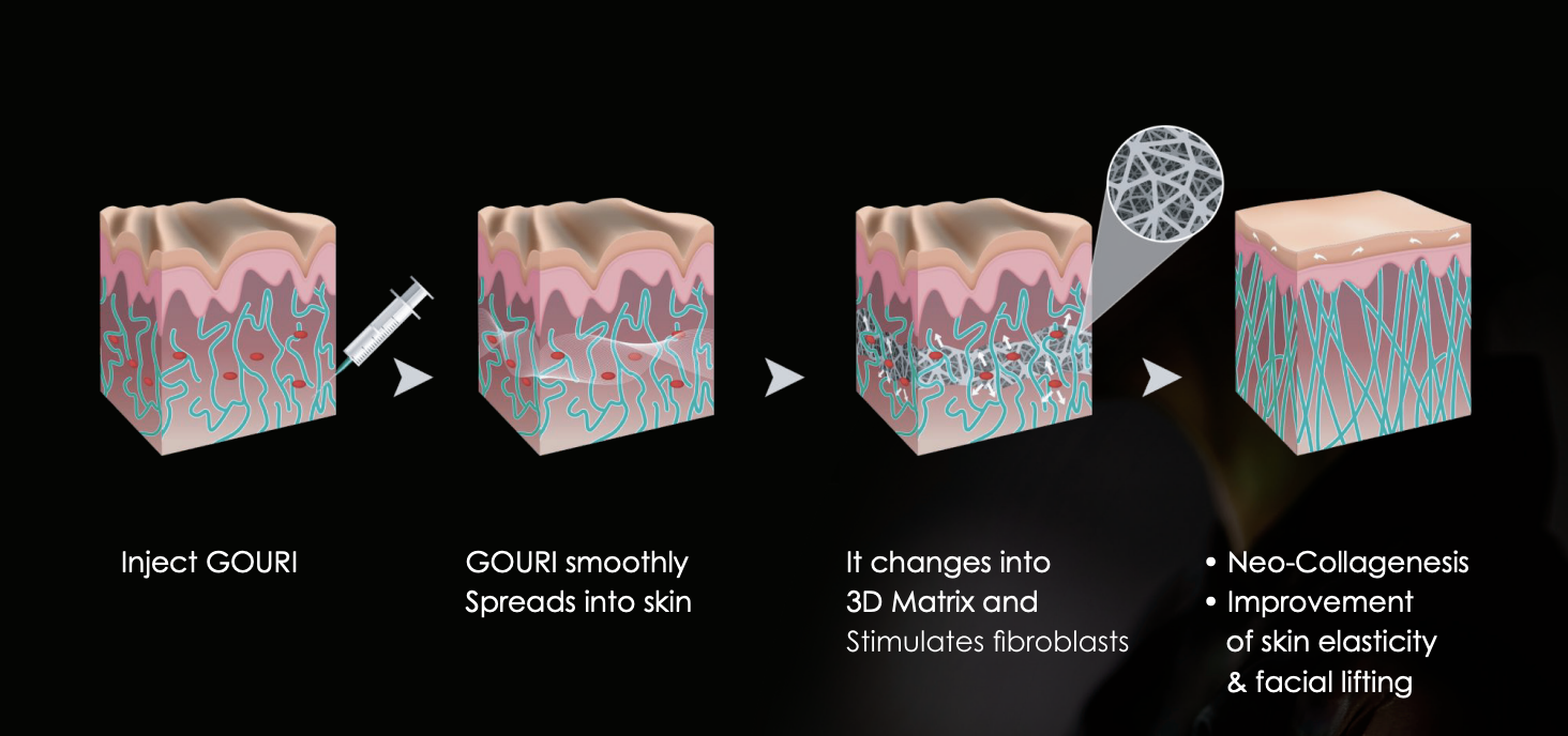 How Does GOURI Work?
