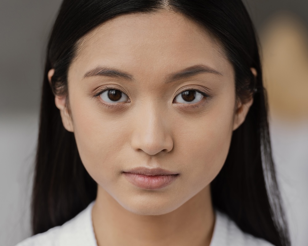 Dark Eye Circles Treatment Singapore