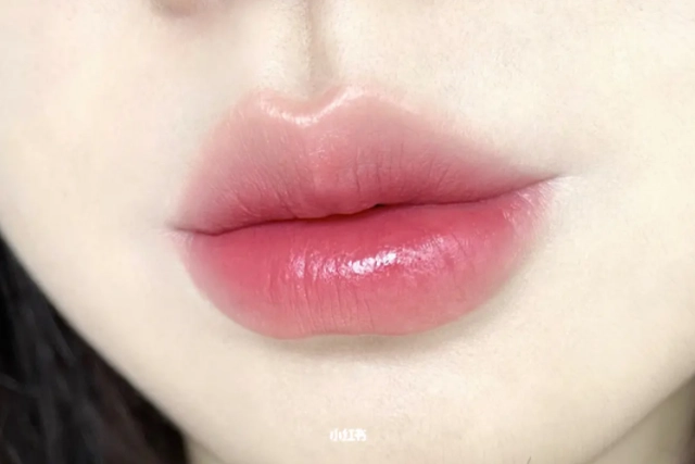 Lip Fillers Singapore Petal Lips Different Lip Shapes