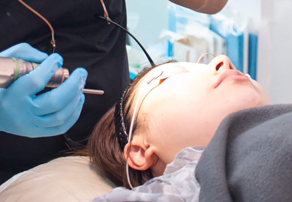 Melasma Laser Treatment Singapore PicoSure